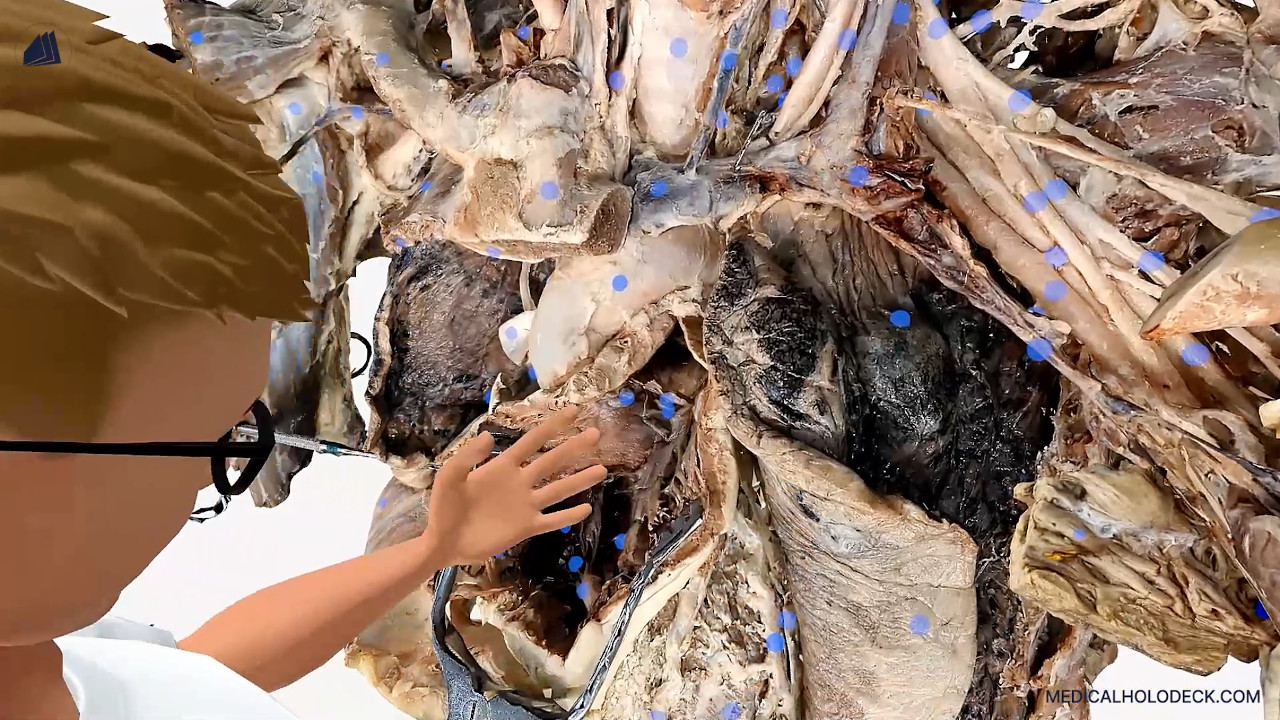 The human heart thumbnail 3